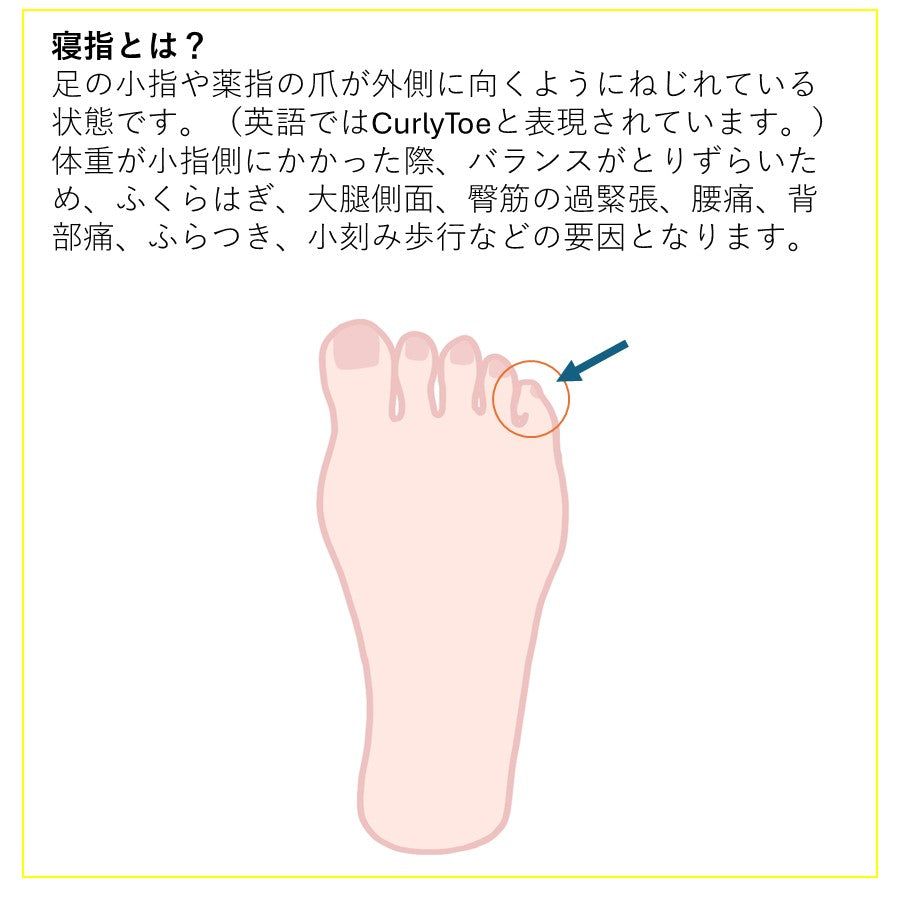 パルキュアソロジー 寝指テープ(1.8cm×5m)【XEROSHOES × New-HALE 】